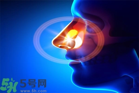 鼻竇炎的高發(fā)人群？如何預(yù)防鼻竇炎？