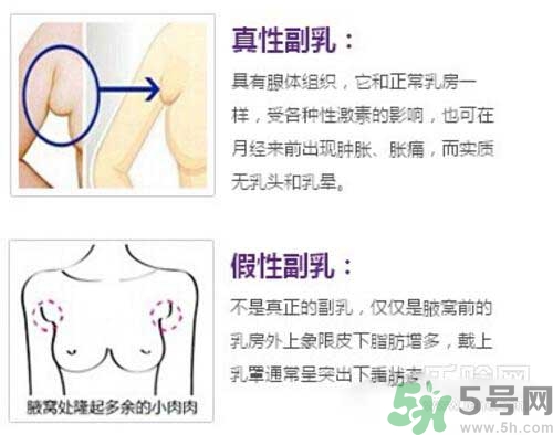 副乳是什么？副乳的危害