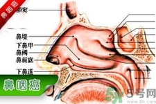 鼻咽癌是什么？鼻咽癌的癥狀有哪些？