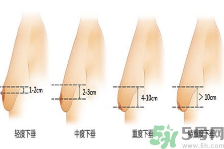 胸部松弛的原因是什么？胸部松弛該怎么辦？