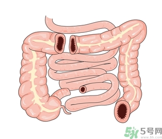 腸炎肚子疼怎么辦？腸炎肚子疼怎么緩解？