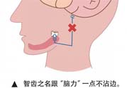 長智齒疼痛怎么辦？長智齒牙齦腫了怎么辦？