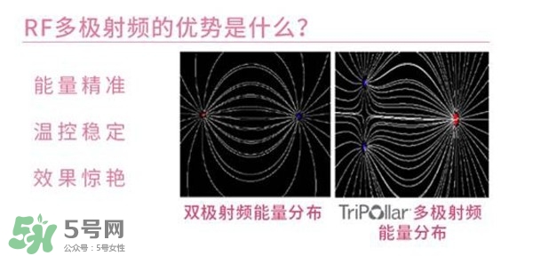 tripollar stop怎么樣？tripollar pose好用嗎