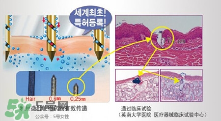 珠兒麗蚊子針好用嗎？珠兒麗蚊子針副作用