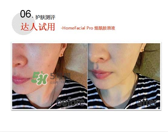 homefacialpro煙酰胺原液怎么樣？hfp煙酰胺原液好用嗎