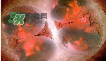 多胞胎是怎么生產(chǎn)的？多胞胎應(yīng)選擇什么分娩方式