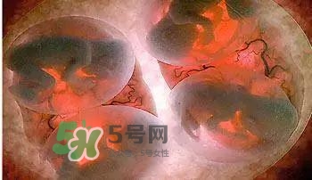 多胞胎順產(chǎn)怎么生？多胞胎剖腹產(chǎn)和單胎剖腹產(chǎn)的區(qū)別