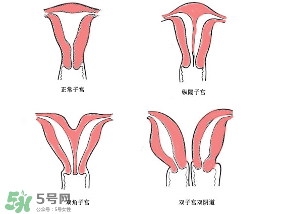 雙子宮是什么意思？雙子宮可以順產(chǎn)嗎？