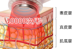 導(dǎo)出儀的正確使用方法