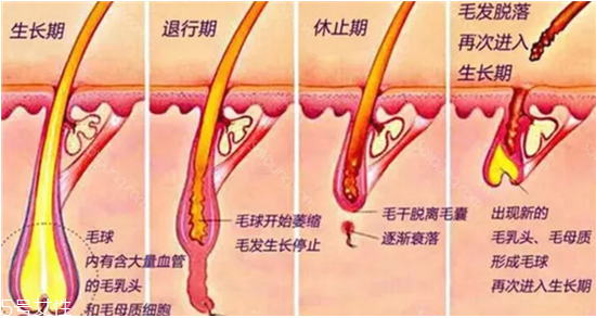 超冰脫毛需要注意什么 超冰脫毛的優(yōu)勢