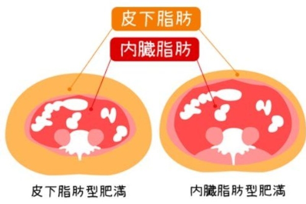 內(nèi)臟脂肪和皮下脂肪的區(qū)別 內(nèi)臟脂肪怎么減肥