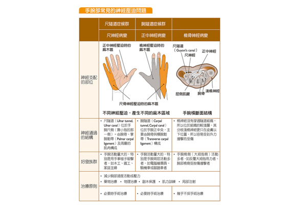 手麻每天4動(dòng)作 解決神經(jīng)壓迫