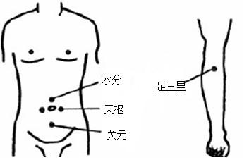 腹部拔罐會影響月經(jīng)嗎 腹部拔罐減肥的時間多久較好